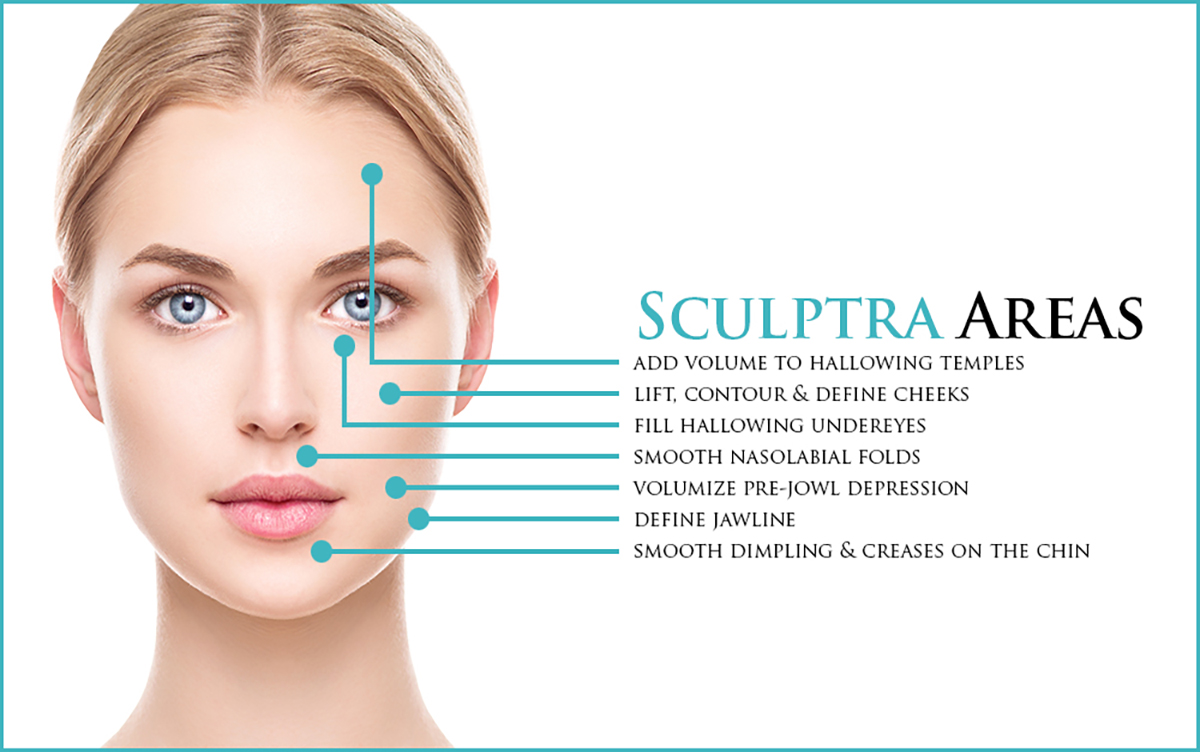 Sculptra